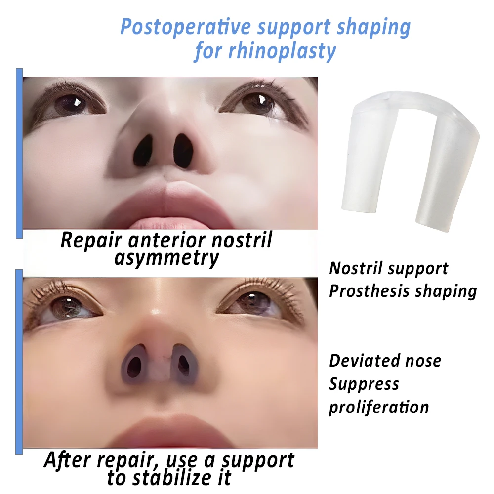Supporto per narice per rinopl - Anti Snore Contour Pillow recensione e prezzo